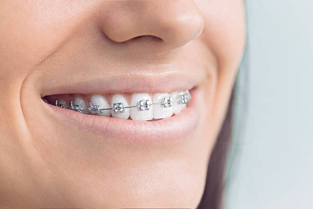Trusted Venice, FL  Holistic Dental Services Experts